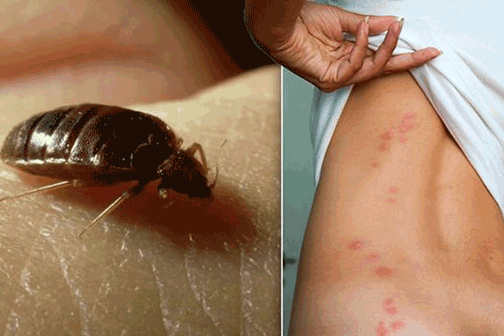 cleanvermine-lutte-anti-nuisibles-punaises-de-lit